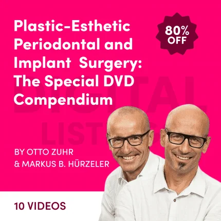 Plastic-Esthetic Periodontal and Implant Surgery: The Special DVD Compendium